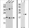 CFL1 antibody, LS-B10157, Lifespan Biosciences, Western Blot image 