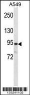 Plakophilin 3 antibody, 58-087, ProSci, Western Blot image 