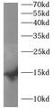 Synuclein Beta antibody, FNab10048, FineTest, Western Blot image 