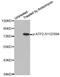 Activating Transcription Factor 2 antibody, MBS128509, MyBioSource, Western Blot image 