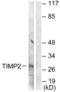 TIMP Metallopeptidase Inhibitor 2 antibody, LS-C118596, Lifespan Biosciences, Western Blot image 