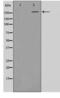 Acetyl-CoA Carboxylase Alpha antibody, LS-C416794, Lifespan Biosciences, Western Blot image 