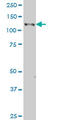 EPH Receptor B3 antibody, LS-C133176, Lifespan Biosciences, Western Blot image 