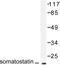 Somatostatin antibody, LS-C176212, Lifespan Biosciences, Western Blot image 