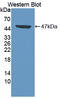 Cyclin-dependent kinase 8 antibody, LS-C712369, Lifespan Biosciences, Western Blot image 