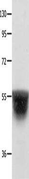 Potassium Voltage-Gated Channel Subfamily A Member 1 antibody, CSB-PA620771, Cusabio, Western Blot image 