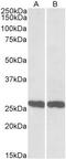 Ubiquitin C-Terminal Hydrolase L1 antibody, GTX88060, GeneTex, Western Blot image 
