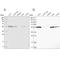 Aldehyde Dehydrogenase 5 Family Member A1 antibody, NBP1-86996, Novus Biologicals, Western Blot image 