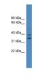 Ubiquitin Recognition Factor In ER Associated Degradation 1 antibody, orb331042, Biorbyt, Western Blot image 