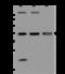 DNA Polymerase Beta antibody, 204411-T44, Sino Biological, Western Blot image 