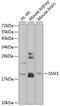 Sorting Nexin 3 antibody, 14-960, ProSci, Western Blot image 