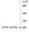 Eukaryotic Translation Initiation Factor 4E antibody, LS-C178084, Lifespan Biosciences, Western Blot image 