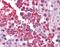 RuvB Like AAA ATPase 2 antibody, NBP1-33373, Novus Biologicals, Immunohistochemistry frozen image 