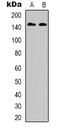 Erb-B2 Receptor Tyrosine Kinase 3 antibody, abx133464, Abbexa, Western Blot image 