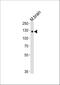 TYRO3 Protein Tyrosine Kinase antibody, M00913-1, Boster Biological Technology, Western Blot image 