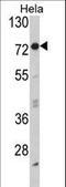 Eukaryotic Translation Initiation Factor 2 Alpha Kinase 1 antibody, LS-C101223, Lifespan Biosciences, Western Blot image 