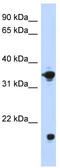 Glycerol-3-phosphate dehydrogenase [NAD+], cytoplasmic antibody, TA346401, Origene, Western Blot image 