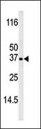 BCL2 Interacting Killer antibody, PA5-12556, Invitrogen Antibodies, Western Blot image 