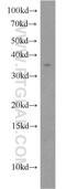 Tetraspanin 7 antibody, 18695-1-AP, Proteintech Group, Western Blot image 