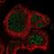 Rab Geranylgeranyltransferase Subunit Alpha antibody, NBP1-87197, Novus Biologicals, Immunocytochemistry image 