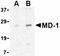 Adenylate Cyclase 3 antibody, orb5798, Biorbyt, Western Blot image 