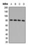 G Protein-Coupled Receptor Kinase 2 antibody, orb393198, Biorbyt, Western Blot image 