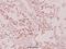 Eukaryotic Translation Initiation Factor 4B antibody, A00846S422-1, Boster Biological Technology, Immunohistochemistry paraffin image 