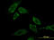 Carbonyl Reductase 3 antibody, LS-C196828, Lifespan Biosciences, Immunofluorescence image 