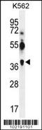 MAGE Family Member A12 antibody, 62-151, ProSci, Western Blot image 