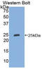 Lipocalin 2 antibody, LS-C295617, Lifespan Biosciences, Western Blot image 