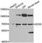 SRY-Box 5 antibody, GTX33514, GeneTex, Western Blot image 