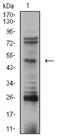 Transcription Factor AP-2 Beta antibody, NBP2-61858, Novus Biologicals, Western Blot image 