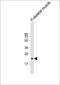 Fibronectin type III domain-containing protein 5 antibody, M02538, Boster Biological Technology, Western Blot image 