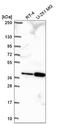 Tubulin Polyglutamylase Complex Subunit 2 antibody, NBP2-57557, Novus Biologicals, Western Blot image 