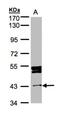 DNA Damage Inducible 1 Homolog 1 antibody, NBP1-31417, Novus Biologicals, Western Blot image 