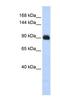 Matrilin 2 antibody, NBP1-53142, Novus Biologicals, Western Blot image 
