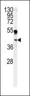 Carbonic Anhydrase 14 antibody, GTX81537, GeneTex, Western Blot image 