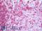 CD74 Molecule antibody, LS-B9952, Lifespan Biosciences, Immunohistochemistry frozen image 