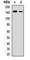 Unc-51 Like Autophagy Activating Kinase 1 antibody, LS-C668637, Lifespan Biosciences, Western Blot image 