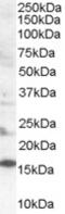 SH2 Domain Containing 1A antibody, MBS421463, MyBioSource, Western Blot image 