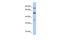 Paired Box 4 antibody, GTX77866, GeneTex, Western Blot image 