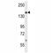 Nuclear Receptor Coactivator 1 antibody, F42033-0.4ML, NSJ Bioreagents, Western Blot image 