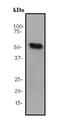 Retinoic Acid Receptor Alpha antibody, ab76074, Abcam, Western Blot image 