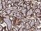 TNF Receptor Superfamily Member 10d antibody, GTX02015, GeneTex, Immunohistochemistry paraffin image 