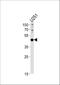 Paired Box 6 antibody, A00273-1, Boster Biological Technology, Western Blot image 