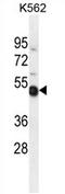 NME/NM23 Family Member 9 antibody, AP54424PU-N, Origene, Western Blot image 