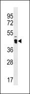 ATPase Family AAA Domain Containing 3C antibody, LS-C159136, Lifespan Biosciences, Western Blot image 