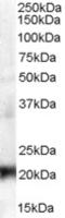 Chromobox 3 antibody, LS-B2396, Lifespan Biosciences, Western Blot image 