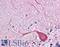 Toll Like Receptor 3 antibody, LS-B4866, Lifespan Biosciences, Immunohistochemistry frozen image 