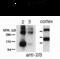 Glutamate Metabotropic Receptor 2 antibody, XPS-2017, ProSci, Western Blot image 